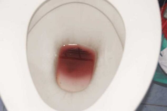 اكتشاف عند الرجال عندما يكون متحمسا